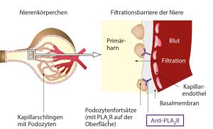 Niere_und_AntiPLA2R_grSchrift_AKBlutseite