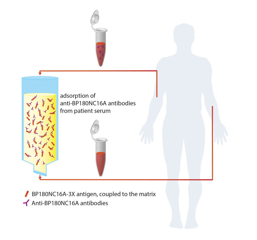 Immunadsorption_02_UK