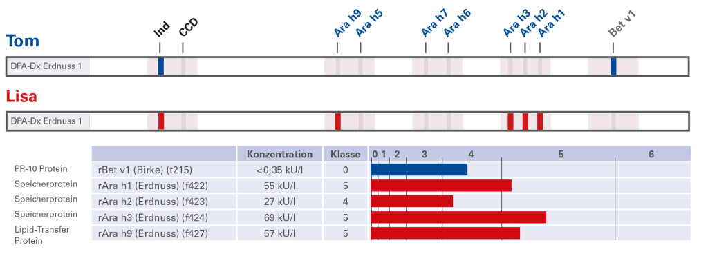 Case Report Peanut Allergy_DE