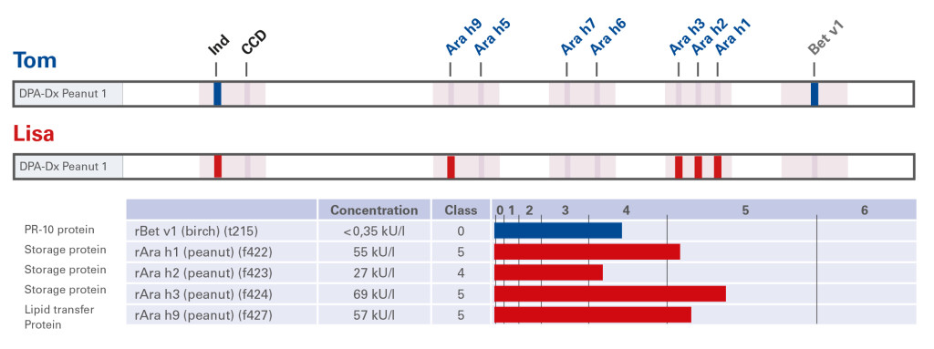 Case Report Peanut Allergy_UK